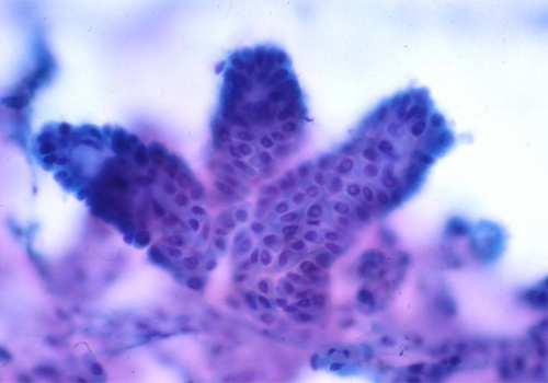 cytopathology